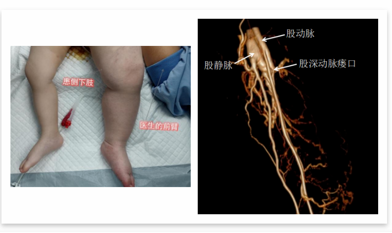 介入1.png