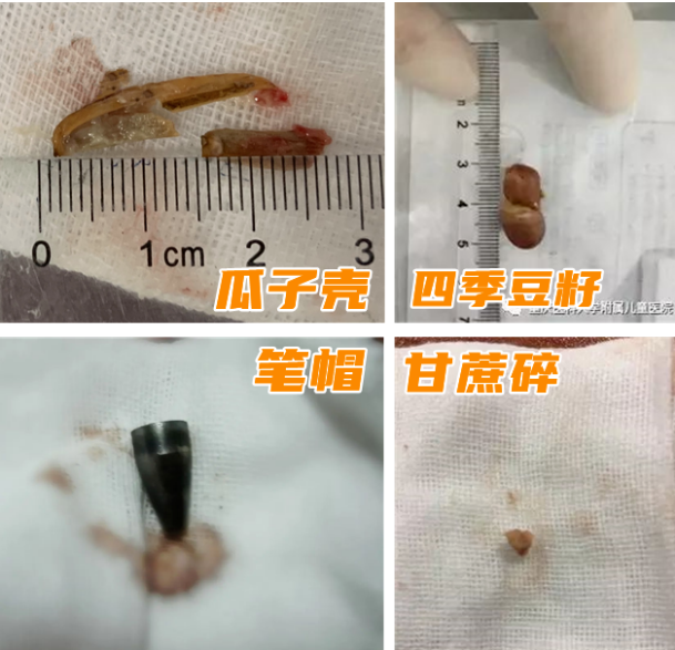 1698106445100967.png 异物拼图.png