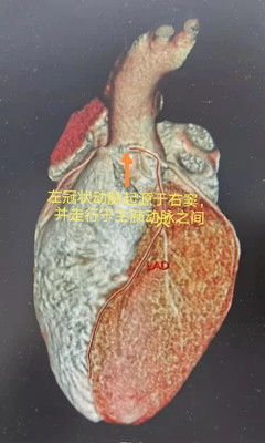 心脏1_副本.jpg