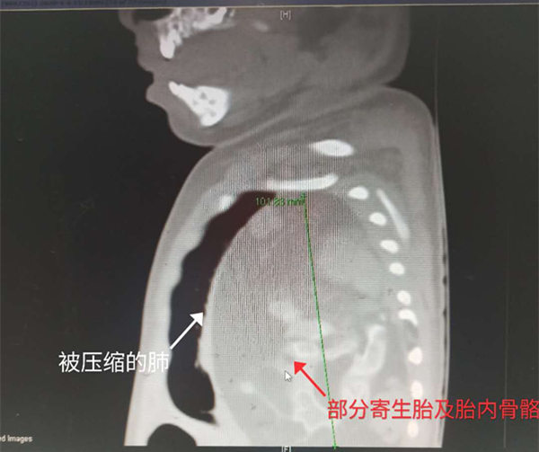 X光胸外_副本.jpg