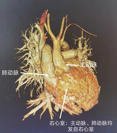 心脏_副本.jpg