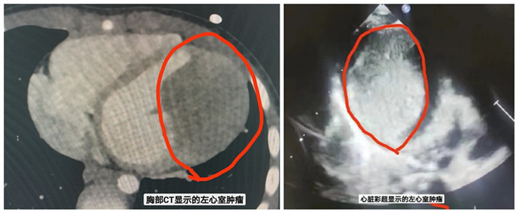 1686532410988157.jpg initpintu_副本.jpg